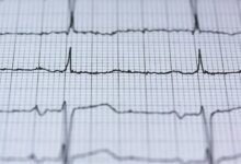 growth ladder for luminous pulse